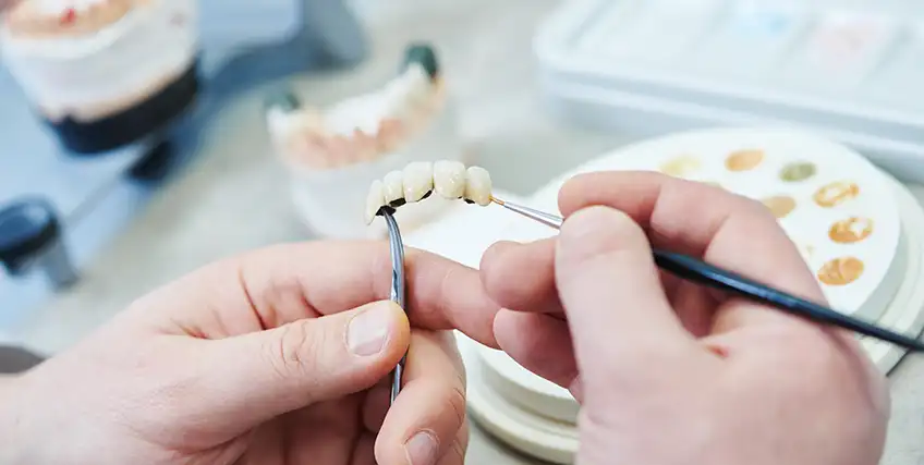 Dental Credit Line Explained: Everything Practice Owners Should Know Before Applying